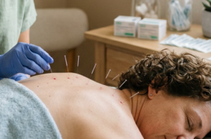 Services firefly acupuncture therapy 741657